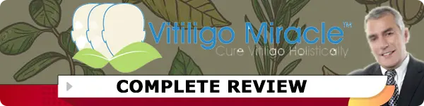 Vitiligo Miracle Review